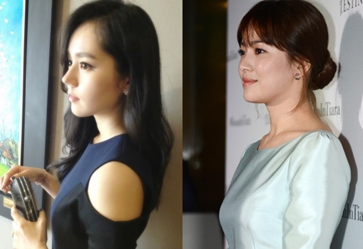 나의 여자 취향은? 전자 VS 후자 .JPG | 인스티즈