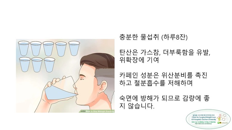 고도비만수술의 대세 위소매절제술 후 일반식하기